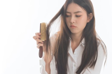 Khắc phục nỗi ám ảnh mang tên “tóc rụng thành từng mảng”