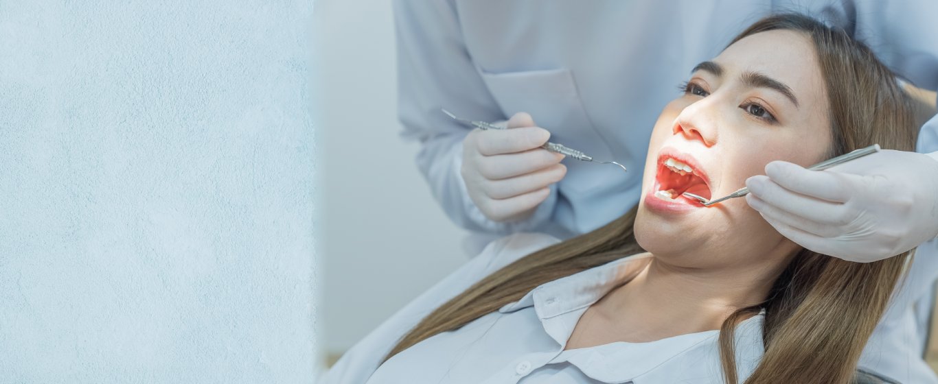 Nhổ răng khôn có được bảo hiểm chi trả không?