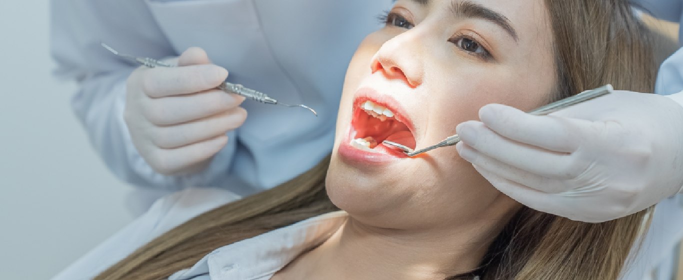 bảo hiểm y tế có chi trả trám răng không