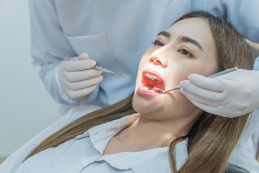 Bảo hiểm y tế có chi trả trám răng không? Mức hưởng thế nào?