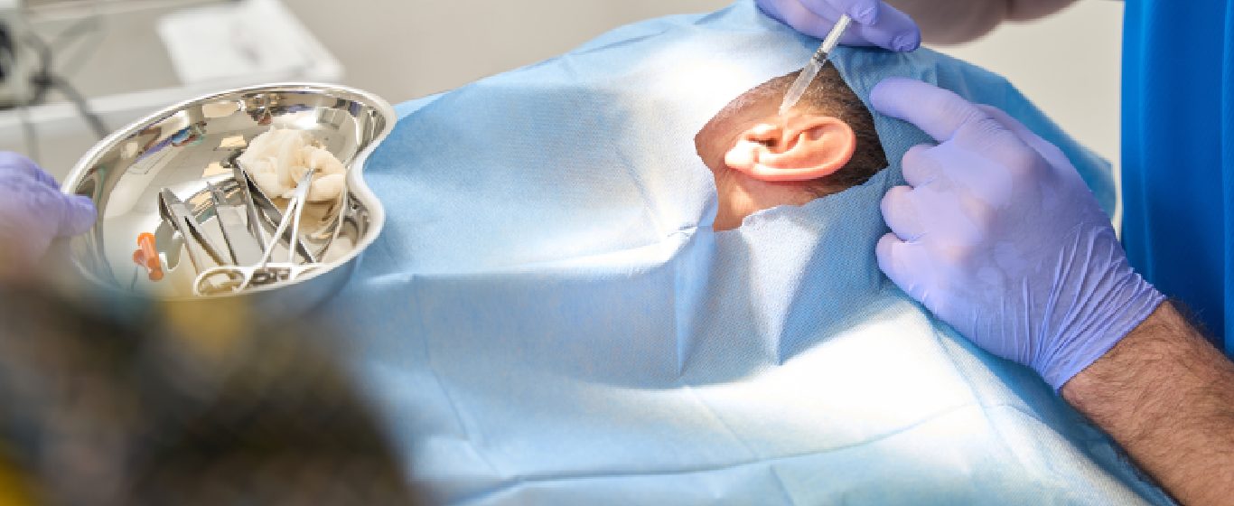 chi phí vá màng nhĩ có bảo hiểm