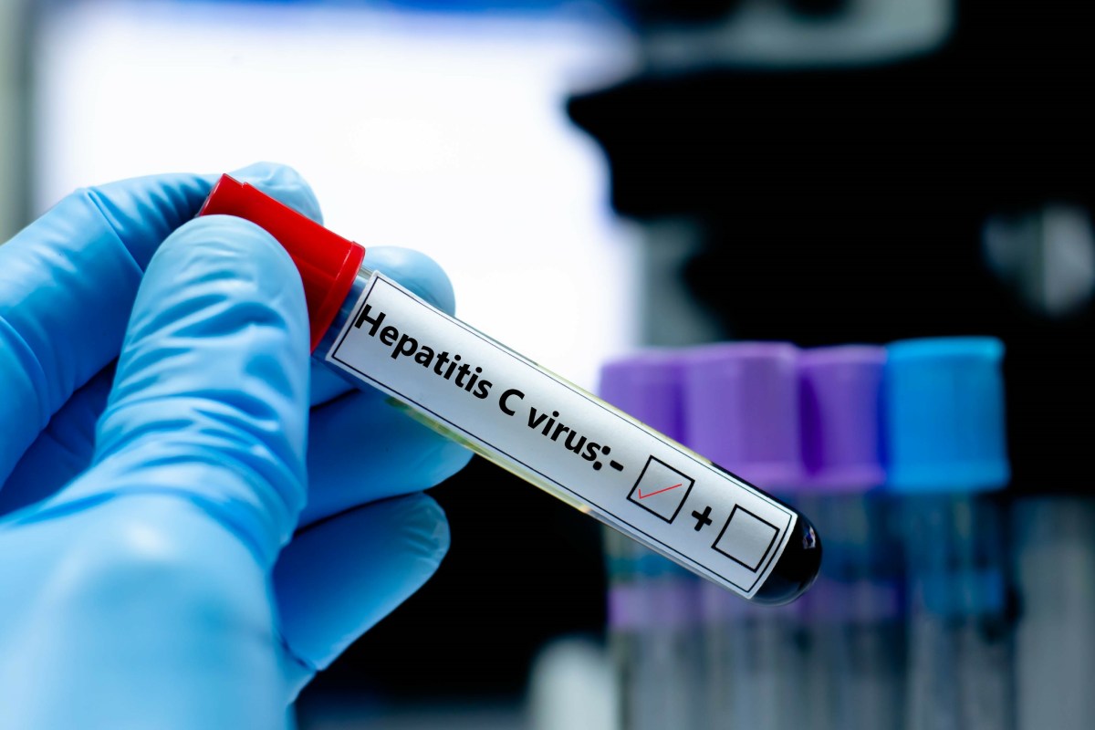 xet-nghiem-viem-gan-b-co-duoc-bao-hiem-y-te-chi-tra-khong-1200x800-1